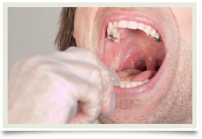 Photo of a throat being examined